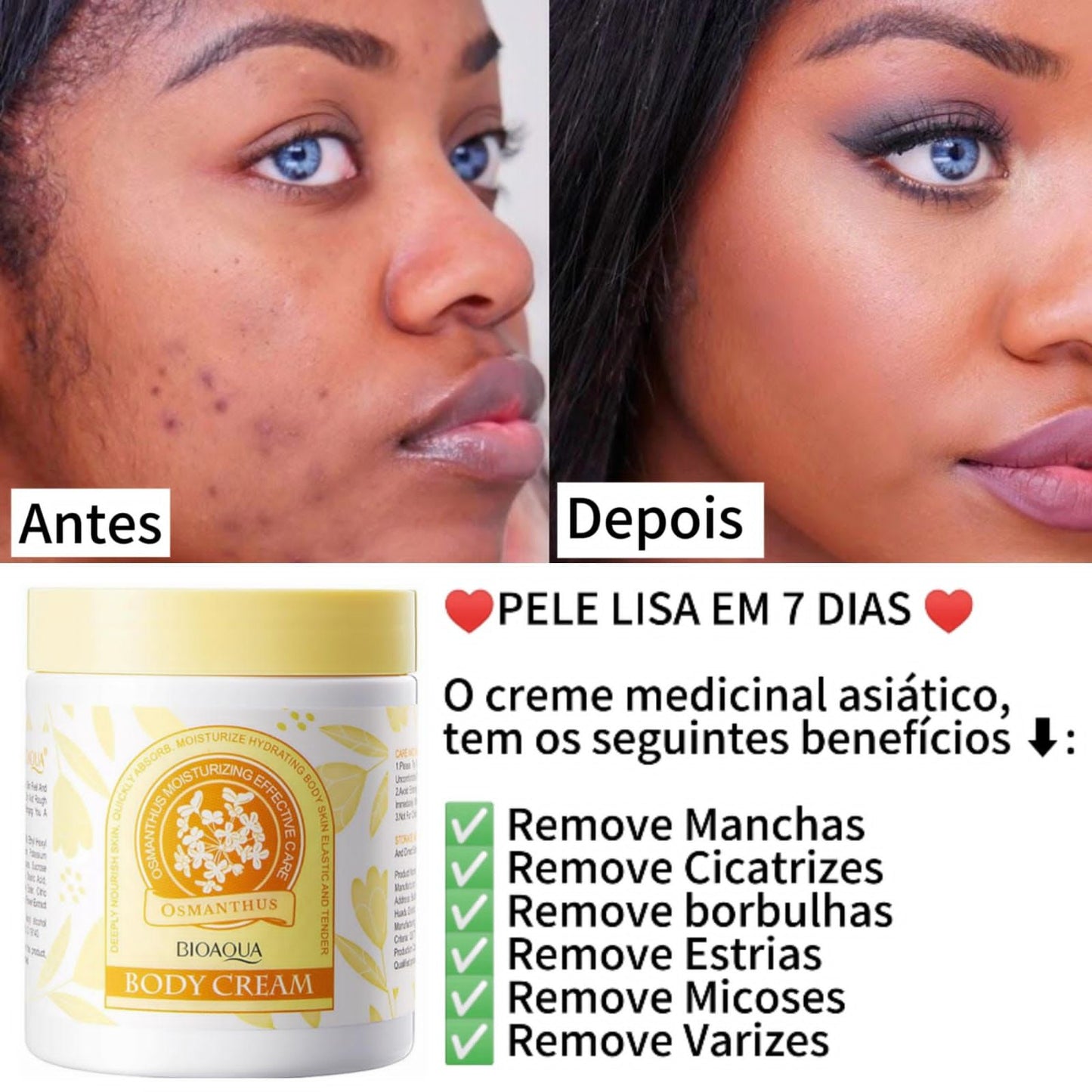 Creme Removedor de Manchas