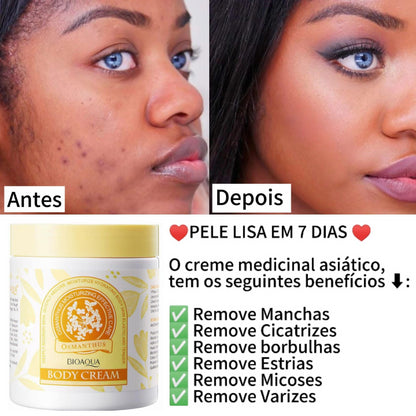 Creme Removedor de Manchas